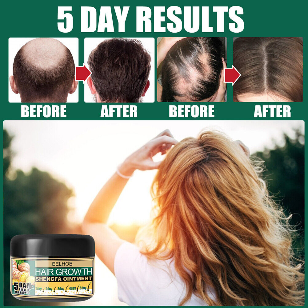 30g Ginger Hair Growth Essential Oil Serum Anti Lost Repair Scalp Treatment