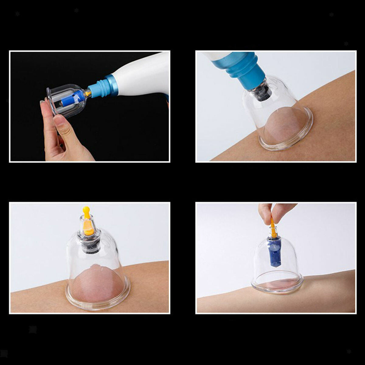 Electric Cupping Kit for Back   Physical Massage  Healthy