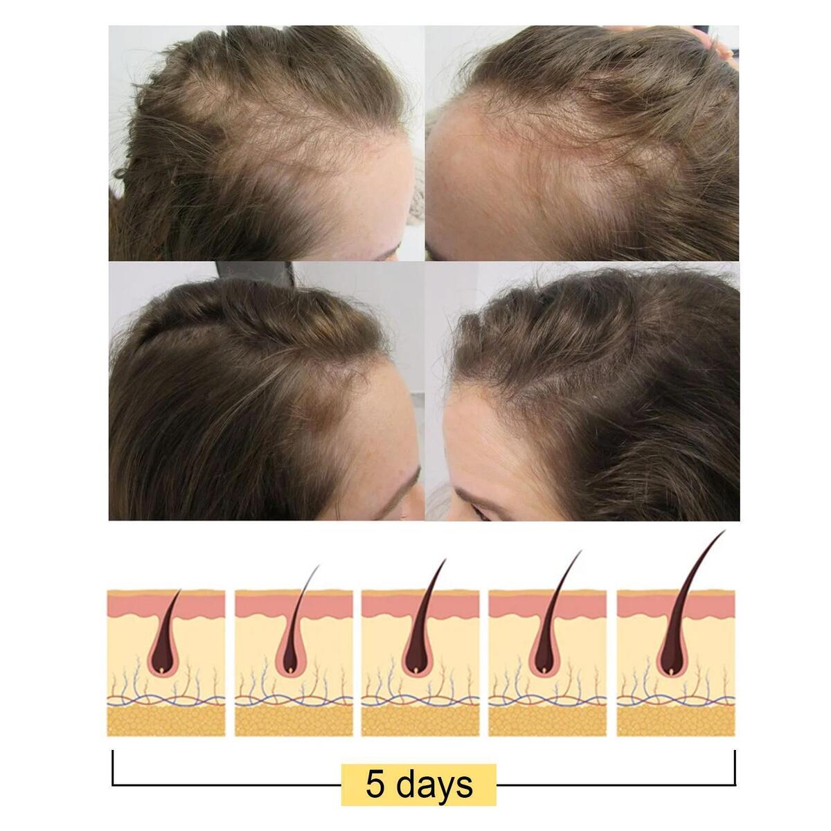 2 Pcs Rice Shampoo Bar Moisturizing Nourishhair Anti Hair Loss, for Women