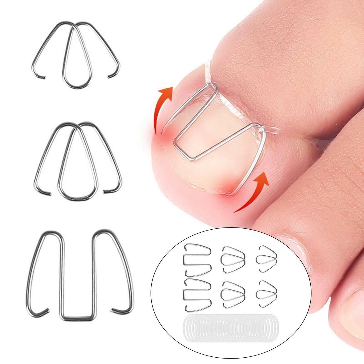 6x Ingrown Toenail Corrector Wire Relieve  Nail Correction Hook