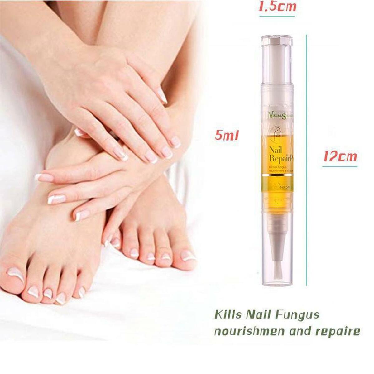Nail   Treatment Toenail/Fingernail  Solution   Stop Nail