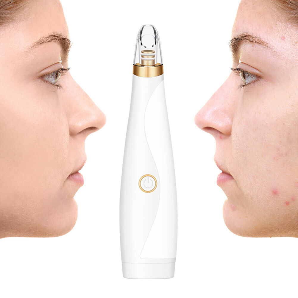 Pore Cleaner Blackhead Remover Vacuum Black Dots Pimples Removal Skin Care