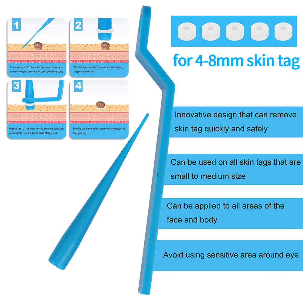 Skin Tag Remover Large Mole Wart with Removal Bands Cleansing Wipes (Blue)