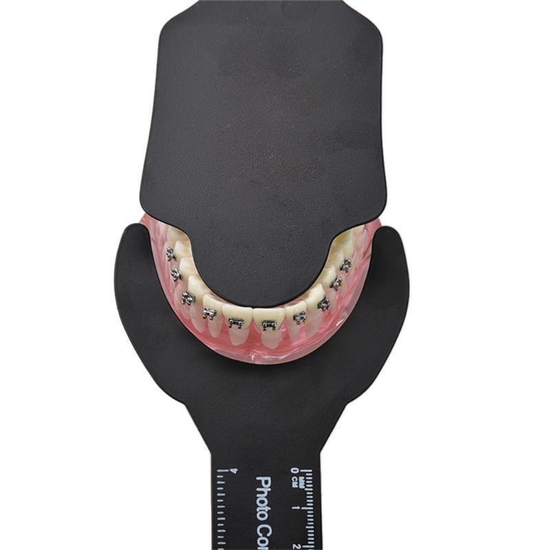 Dental Photo Contrast Oral Black Background Board Palatal Photography Contraster