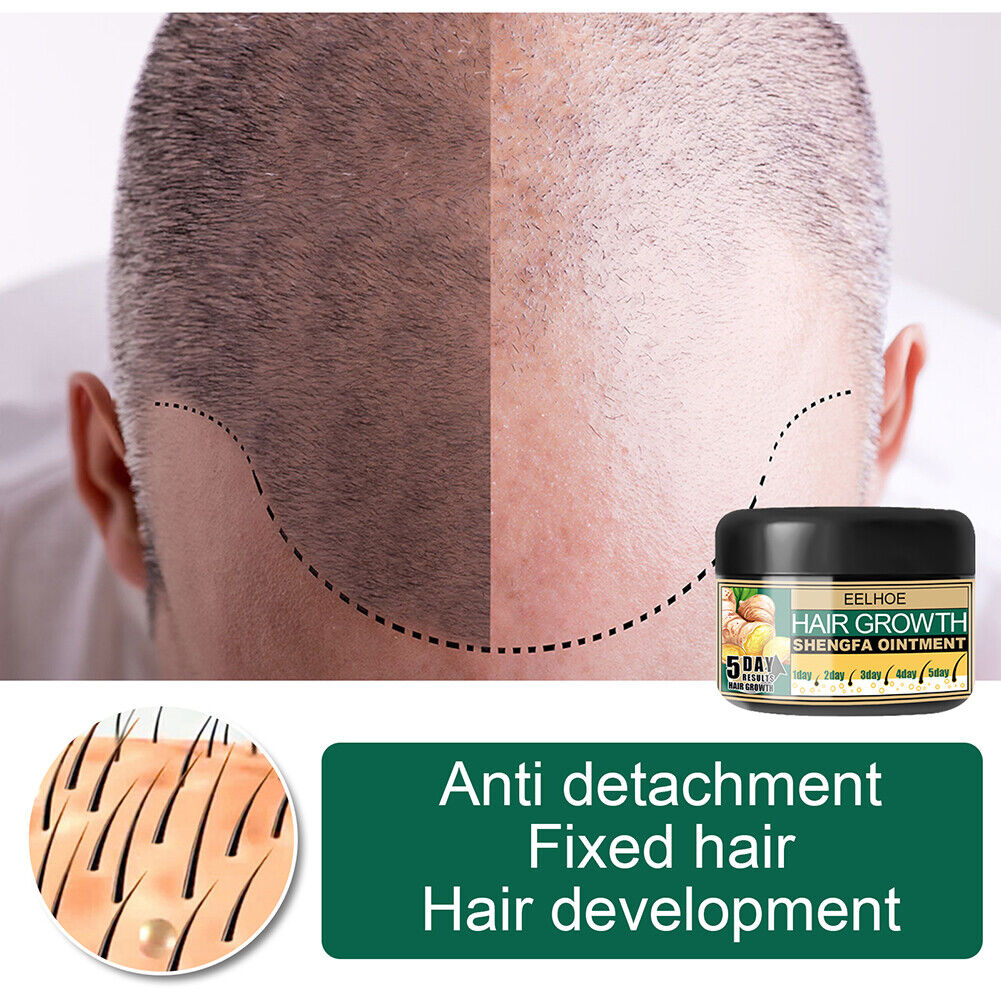 30g Ginger Hair Growth Essential Oil Serum Anti Lost Repair Scalp Treatment