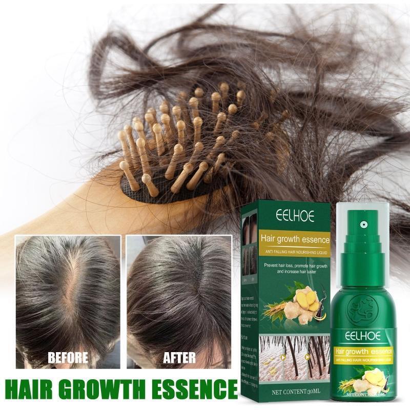 Ginger Essential Oil Stop Hair Loss Hair Thinning Treatment Hair Growth Oil 30ML
