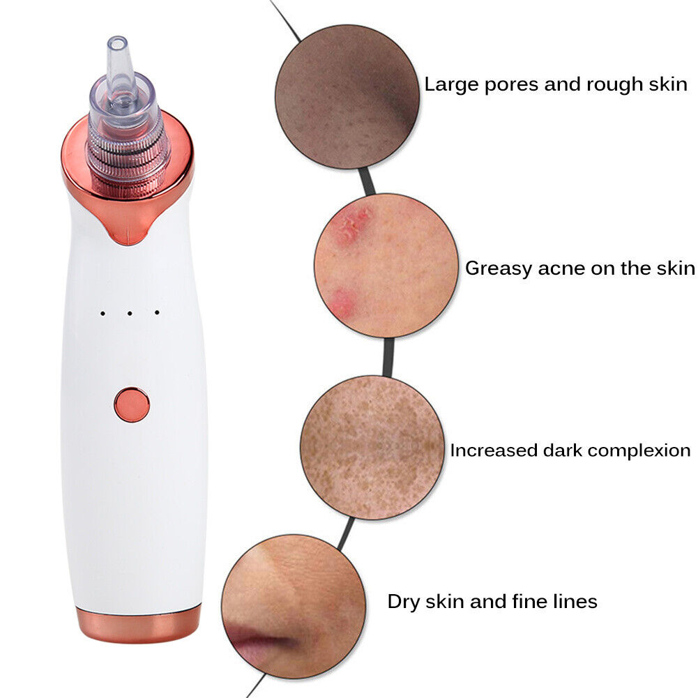 Blackhead Black Dot Remover Face Pore Vacuum Suction Black Head Extractor