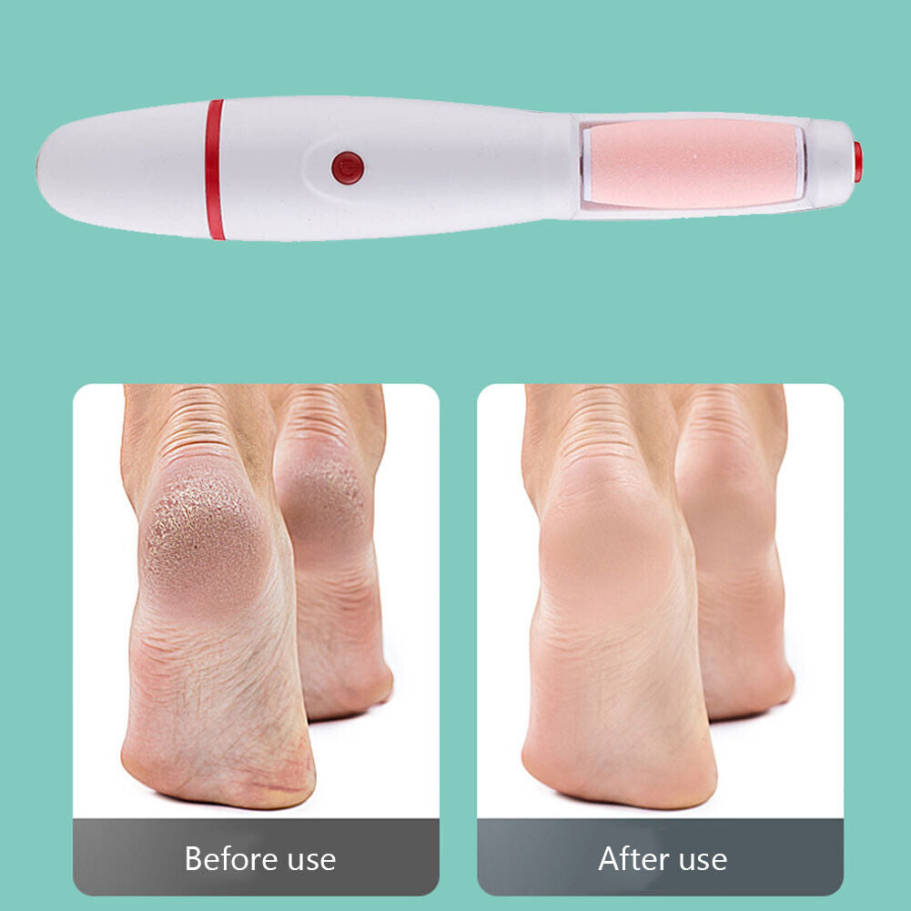 Electric Pedicure Foot Callus Grinder USB Feet Care Dead Skin Remover (Red)