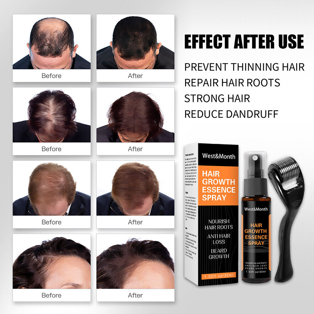 Effective Beard Growth Essence Spray Nourishing Enhancer Oil (Spray Roller)