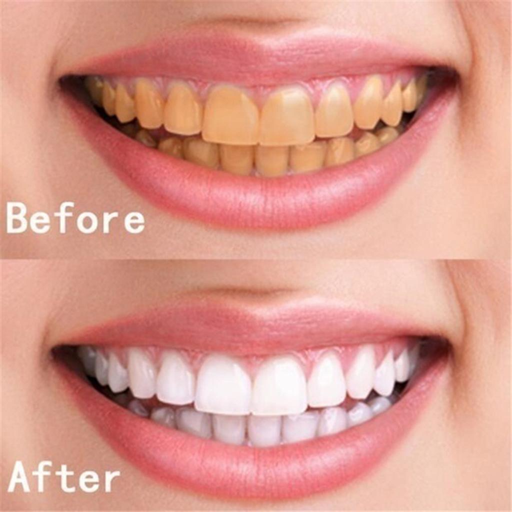 10ml Teeth Whitening Water Oral Hygiene Cleaning Teeth Care Tooth Cleaning