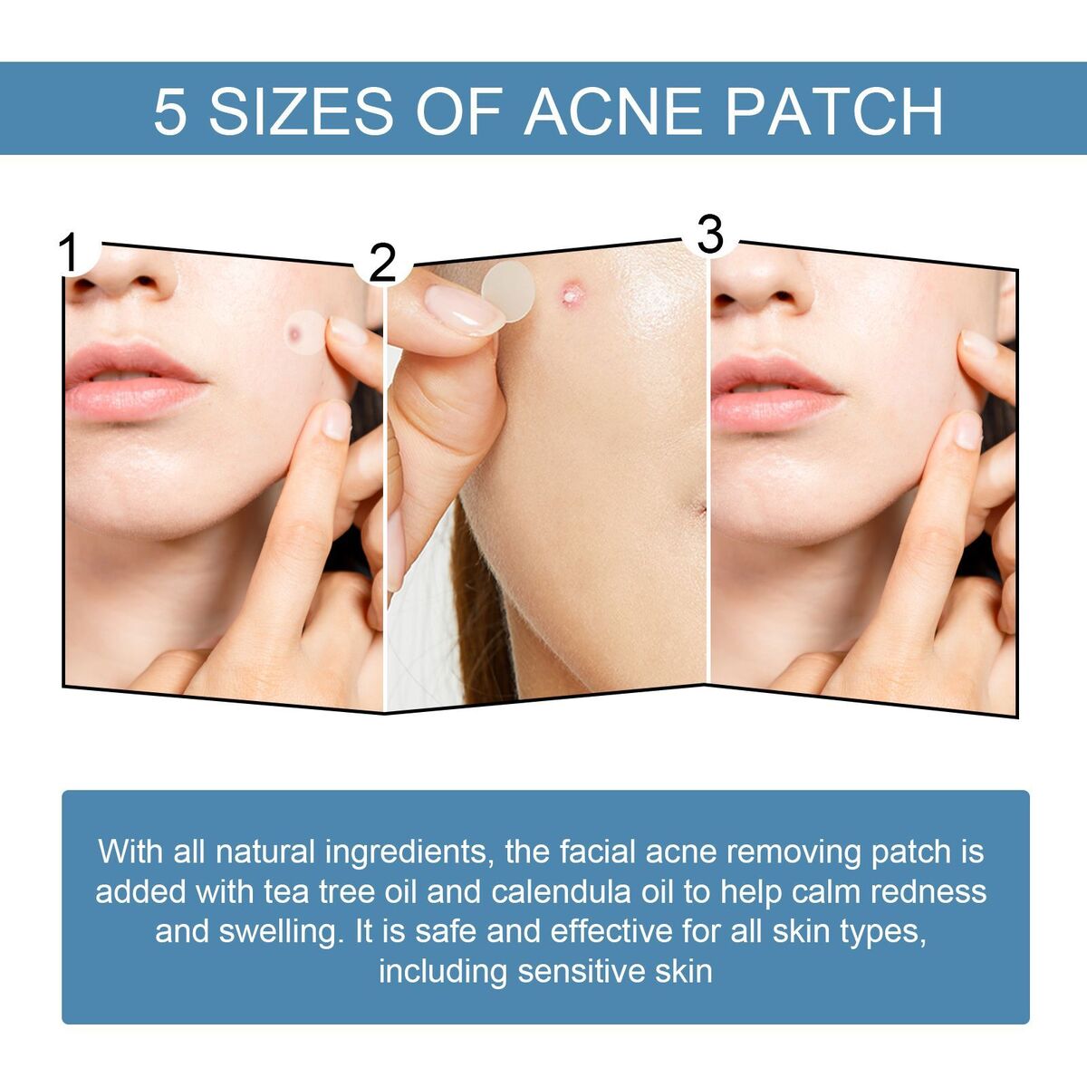 Pimple Patches Hydrocolloid Master Acne Spot Treatment Skin Tag Remover Patch