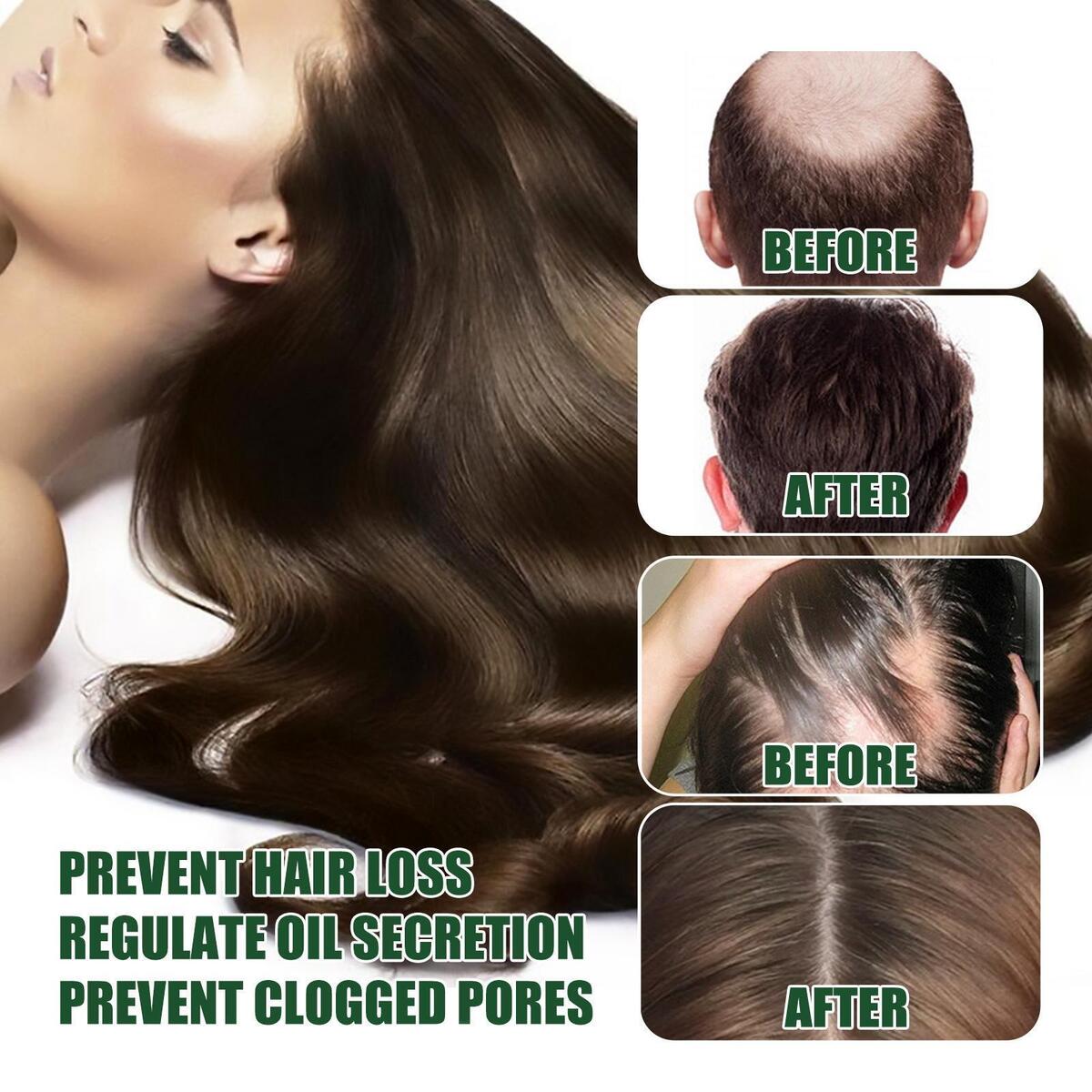 30ml Ginger Hair Growth Serum, Stop Hair Loss Repair Damaged Hair for Dry and