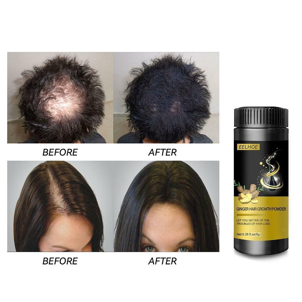 Ginger Hair Growth Powder Repair Treatment Natural Formula Mild Formula Tools