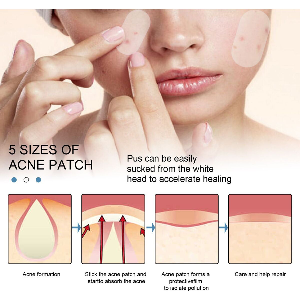 Pimple Patches Hydrocolloid Master Acne Spot Treatment Skin Tag Remover Patch