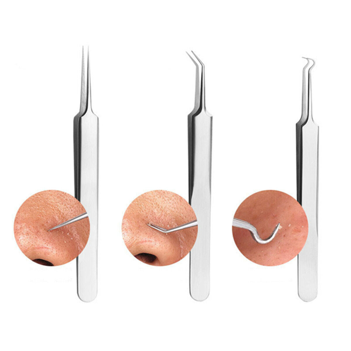 8Pcs Set Blackhead Extractor Tool Remover Pimple Blemish Comedone Kit Acne Clip