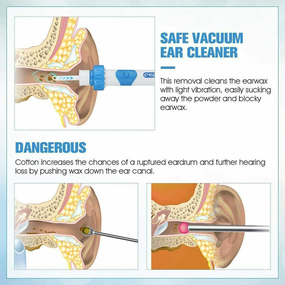 Electric Ear Cleaner Wax Remover Dirt Fluid Removal Device Earwax Cleaning Tool