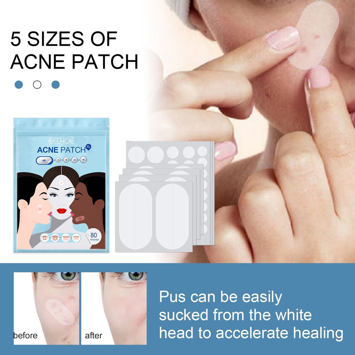 Master Acne Spot Treatment Skin Tag Remover Patch Ance Pimple Patches