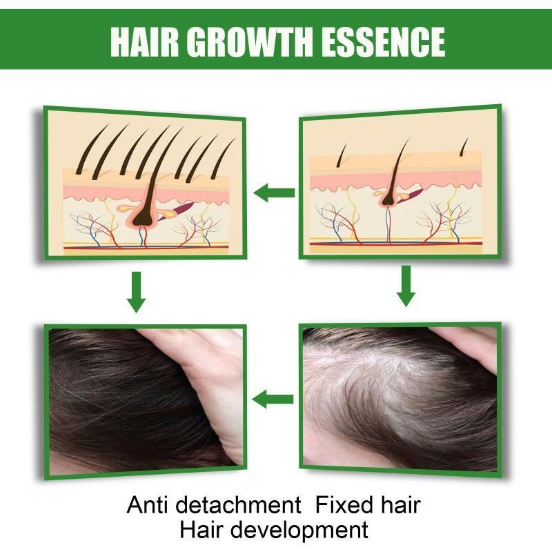 Ginger Essential Oil Stop Hair Loss Hair Thinning Treatment Hair Growth Oil 30ML