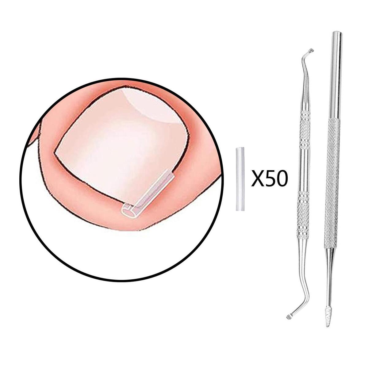50Pcs Ingrown Toenail Corrector Strips Thick Paronychia Pedicure Tool Brace Nail