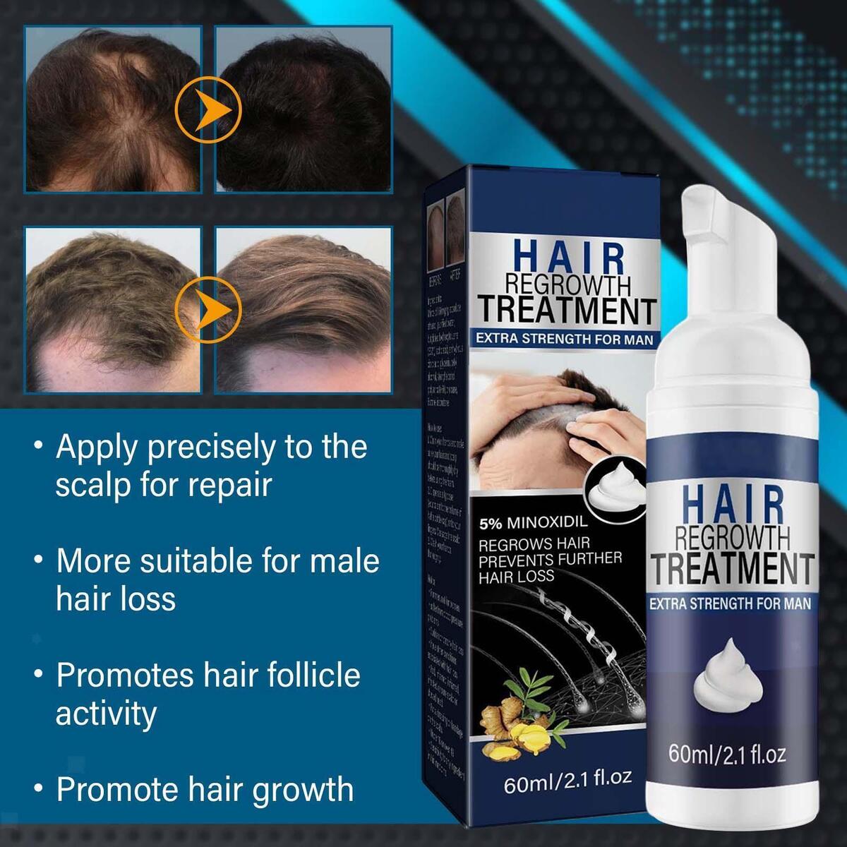 Hair Growth Essence Spray Anti Hair Loss Fast Grow for Prevent Hair Loss