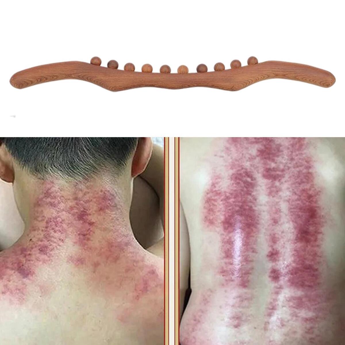 Wood Massage Stick Muscle Relaxation Point Treatment for Shoulder Neck