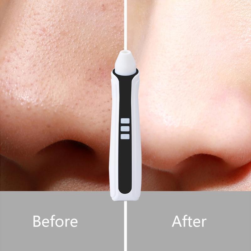 Electric Pore Cleaner Smart Camera Visible Blackhead Remover Comedones Extractor