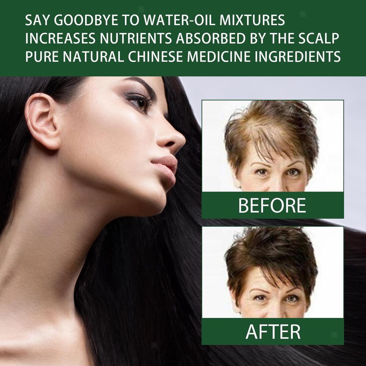 30ml Ginger Hair Growth Serum, Stop Hair Loss Repair Damaged Hair for Dry and