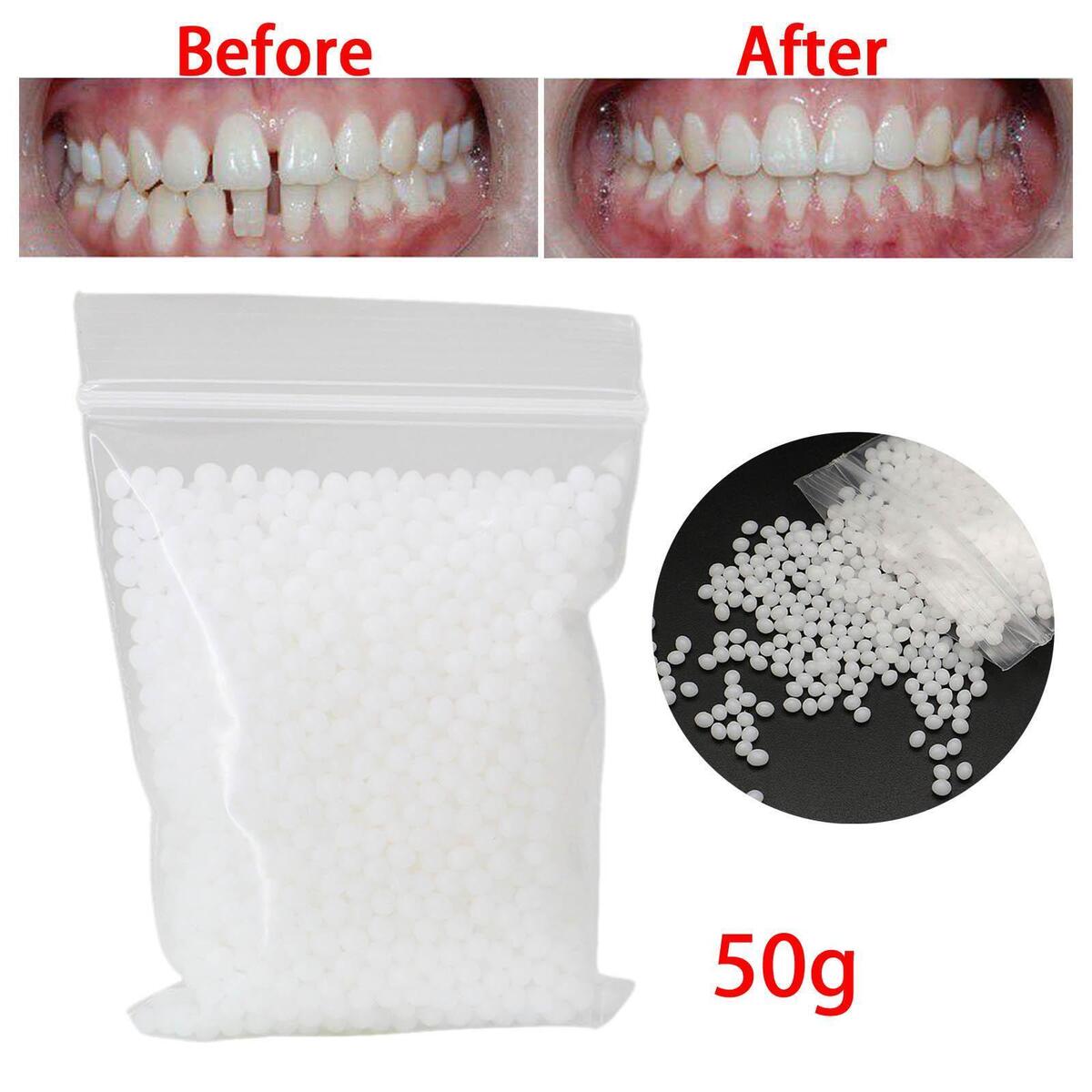 50G Temporary  Repair Kit False  Moldable  Veneers White