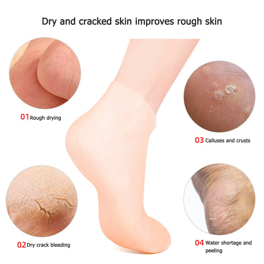 1 Pair Foot Care Socks Moisturizing Gel Cracked Skin Protectors Socks (L)