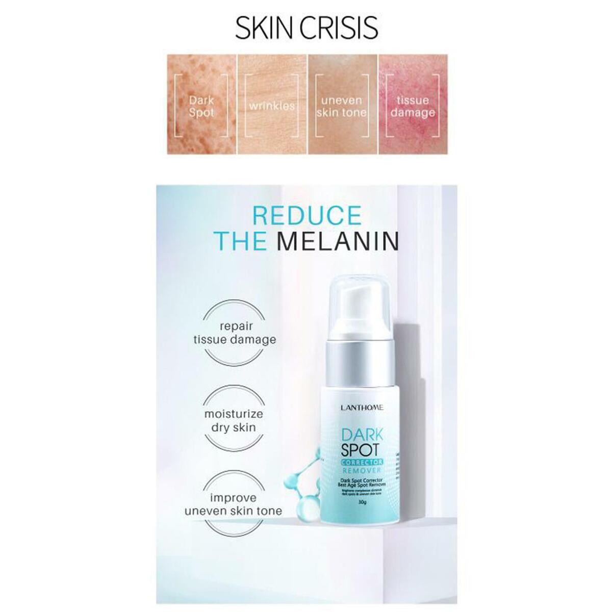 Dark   Freckles Corrector 30g, Soothes Nourishes Skin