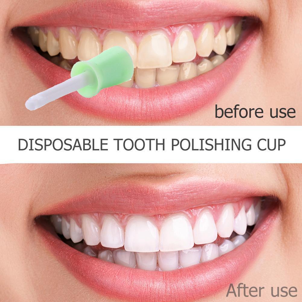 100pcs/box Disposable Dental Polishing Cup Tooth Polish Brush Polisher Cup