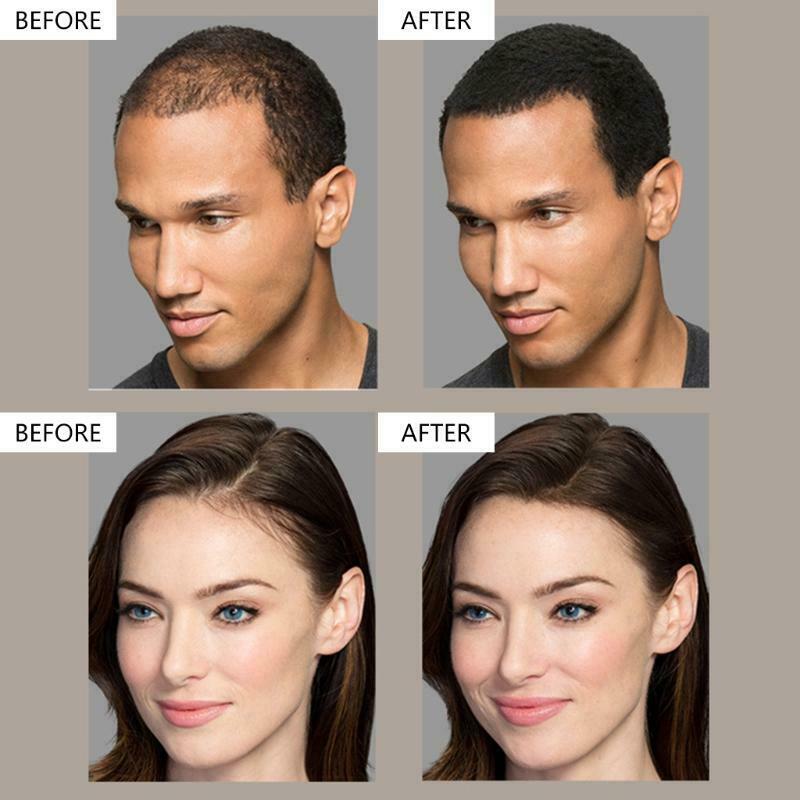 Hair Building Fibers Powder Comb Hairdressing Top Hairline Optimizer Enhancer