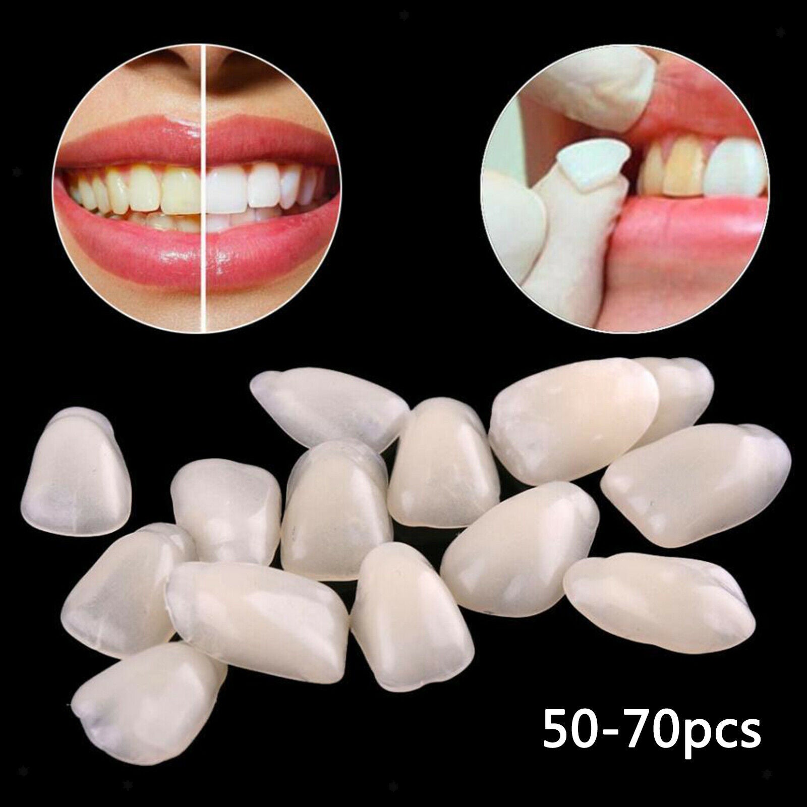 Teeth Temporary Crown Veneers Anterior Front Kit Dentist Products Beige