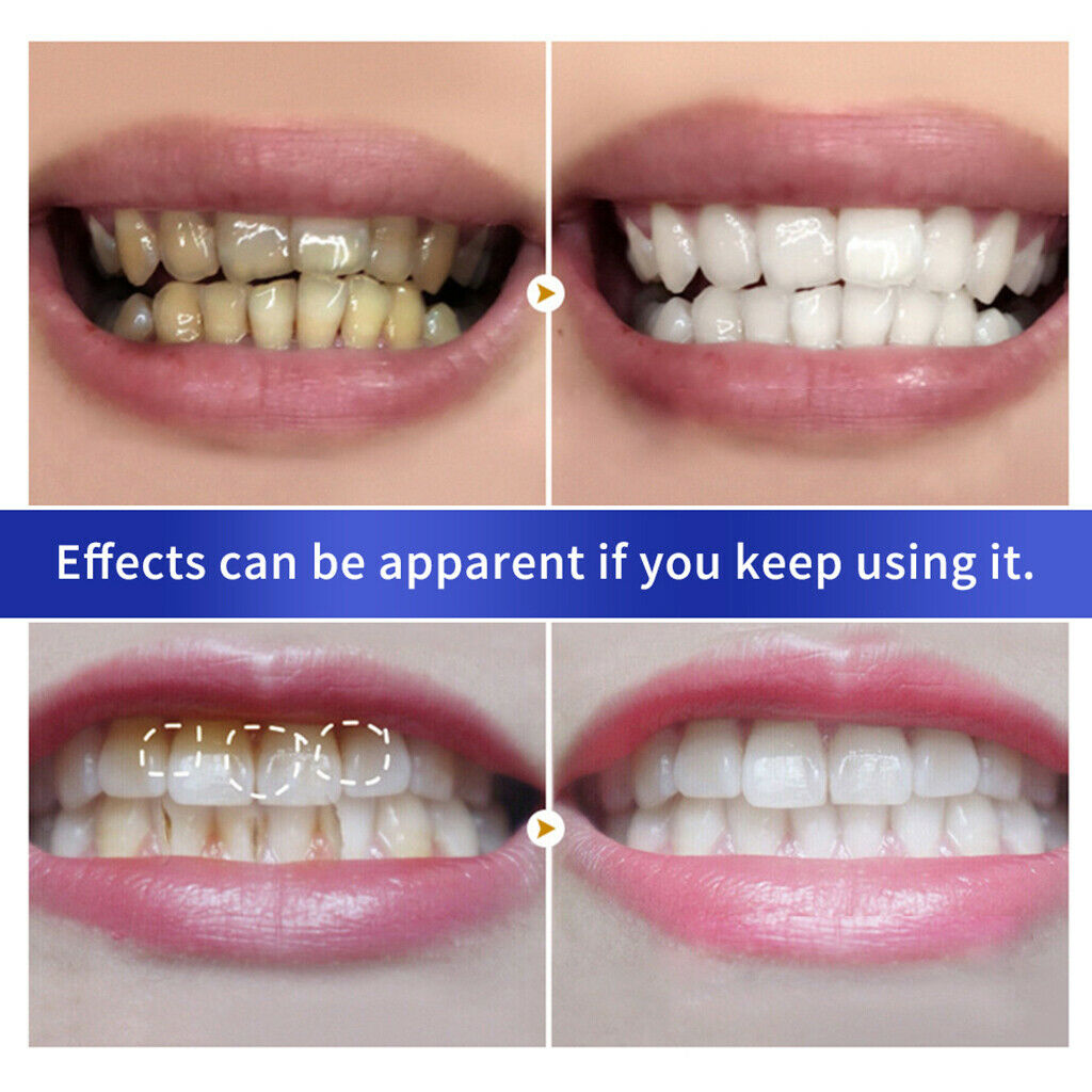 5pcs Teeth Whitening Powder Polish Tooth Supply Kit White Teeth Cleaning