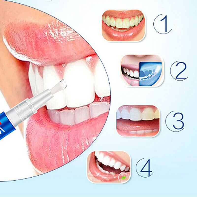 1pc Magic Natural Teeth Whitening Gel Pen Cleaning Remove Stains Care Too.l8