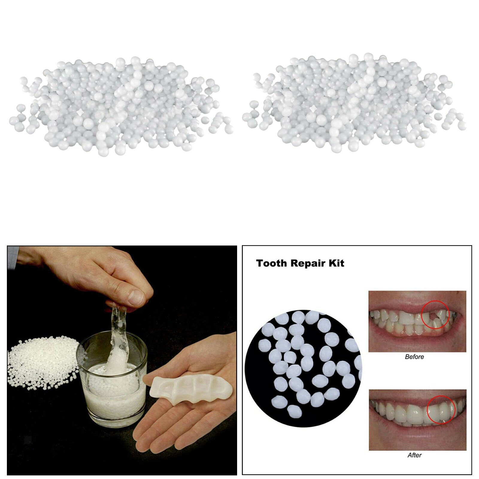 Dental Replacement Thermal Beads 150g Temporary Tooth Repair Kit Beads