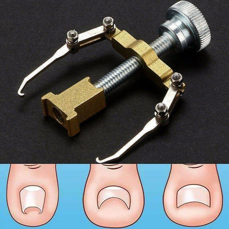 Ingrown Toe foot Nail Correction Fixer Nail Pedicure Tool Toenail Corrector US