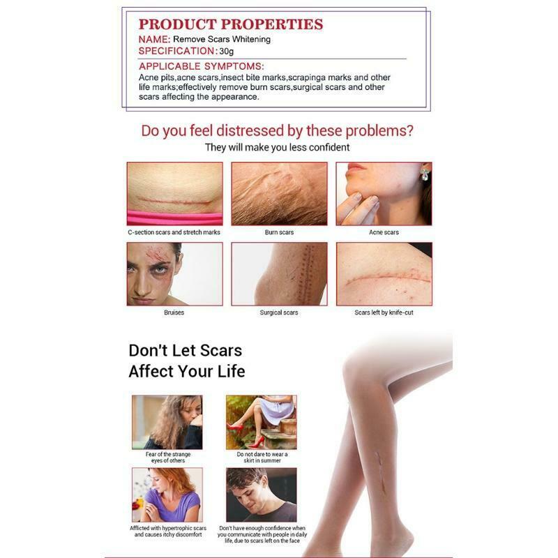 Scar Removal Whitetening Face Serum Scars Treatment Skin Repair for Face Acne
