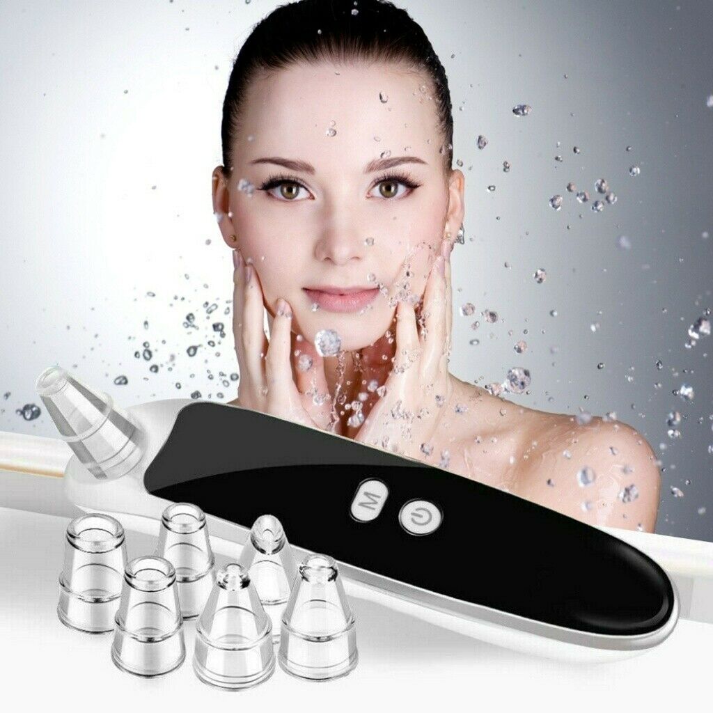 Electric Blackhead Remover Vacuum Suction Facial Acne Pore Cleaner Tool