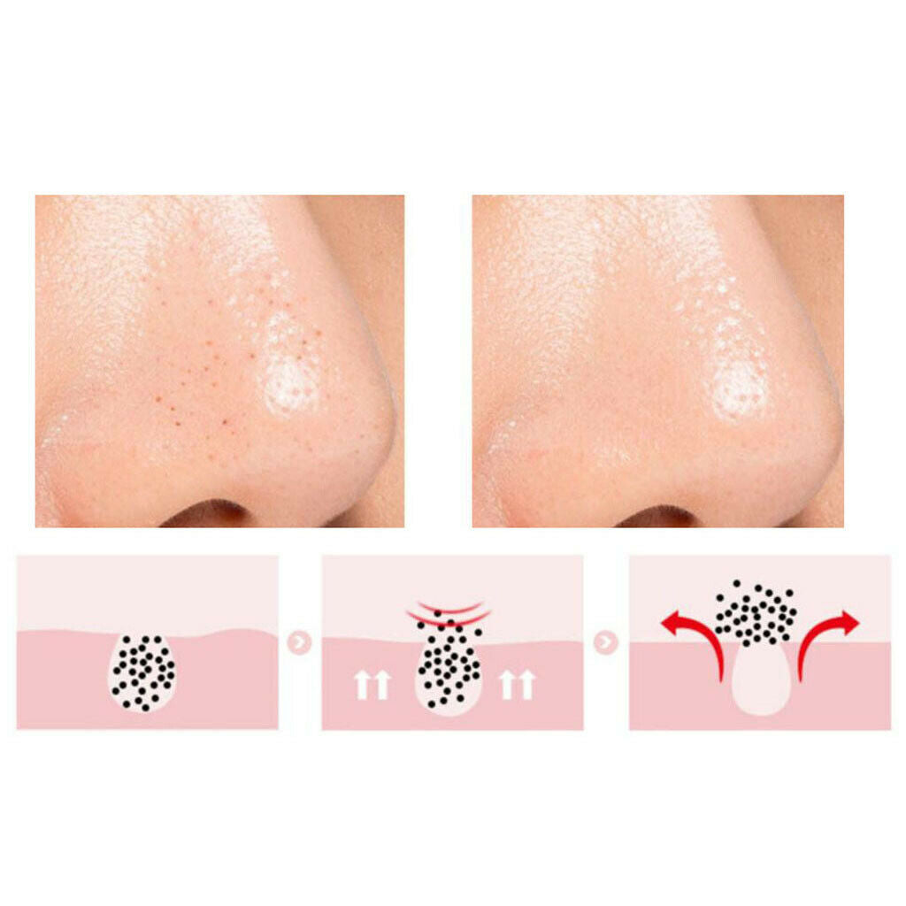 5x Women Men Facial Cleansing Silicone Wash Nasal Brush Blackhead Remove