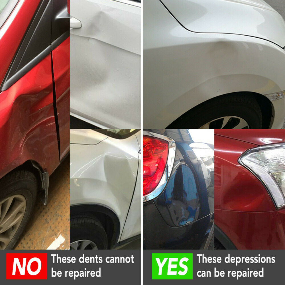 Car Dent Repair Puller Suction Cup Bodywork Panel Tool Repair Kit For Bmw Tesla