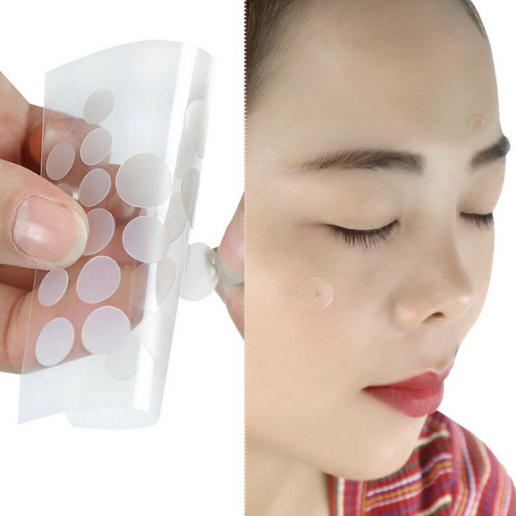 48Pcs Acne Patch Skin Tags Invisible Pimple Master Patch Cover Removal