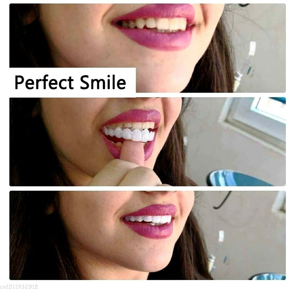 Magic Teeth Brace Temporary Smile Comfort Fit Cosmetic Denture Teeth Dent