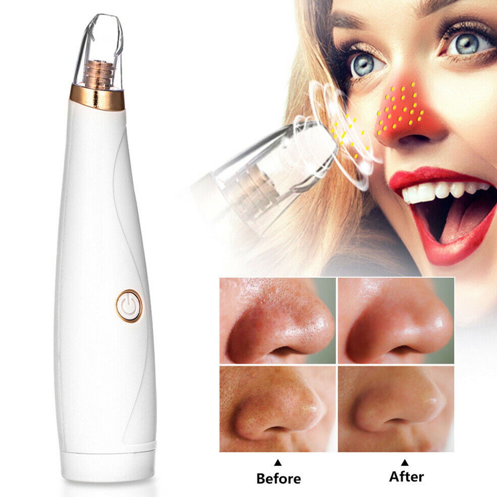 1pc Electric Pore Cleaner Vacuum Blackhead Remover Face Pore Suction Cleaner