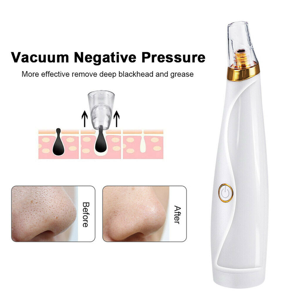 Blackhead Remover Vacuum Pimple Extractor Acne Removal Kit Face Cleaner Care