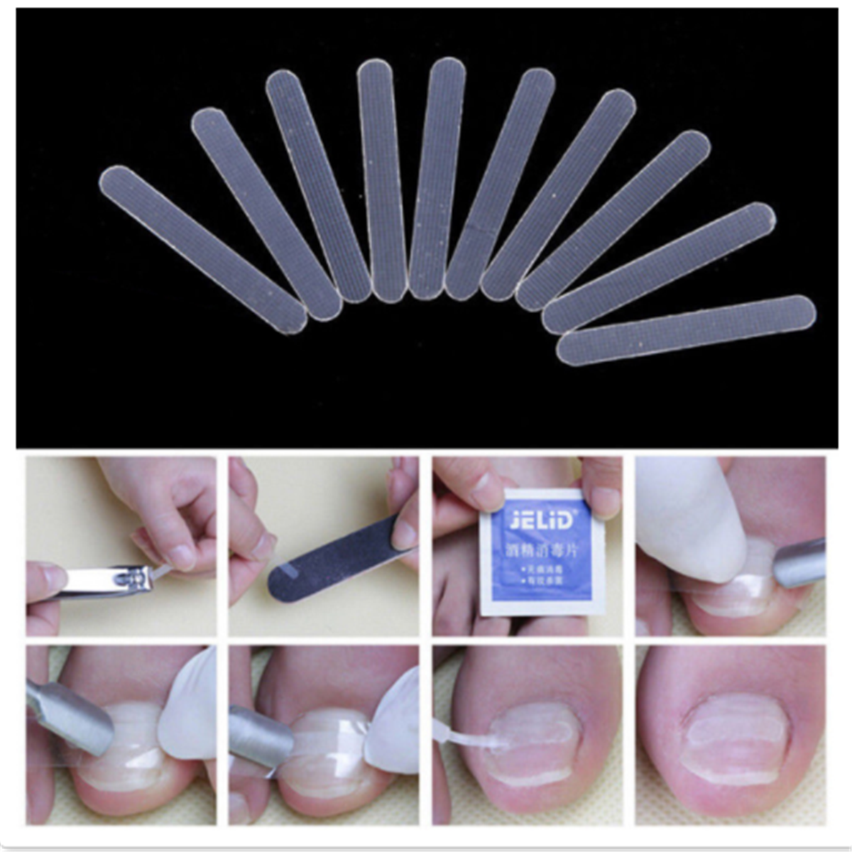 20pcs Ingrown Toenail Straightening Clip Curved Brace Treatment Tool With Glue
