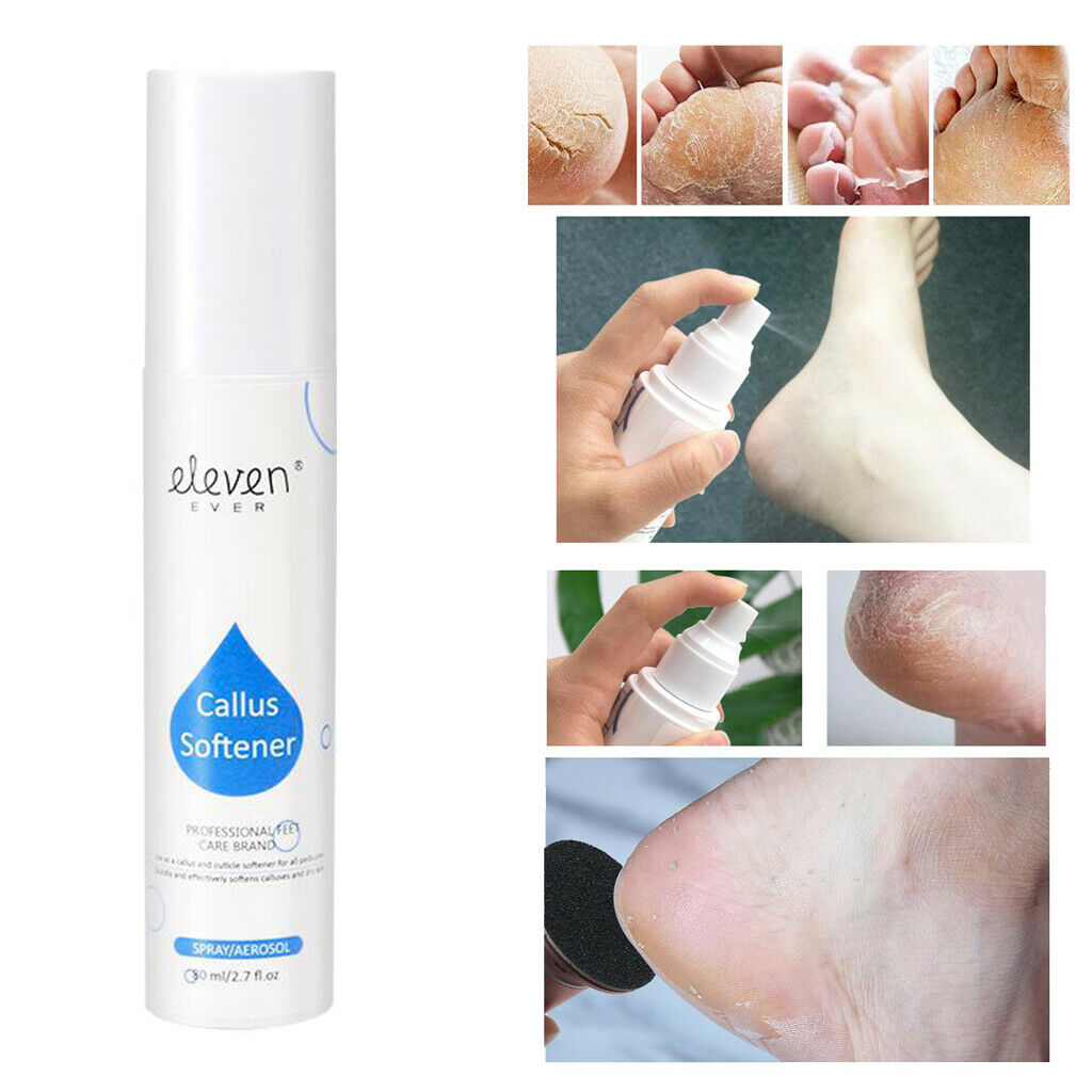 Foot Callus Remover Sprayer, Works well with foot scrubber, file, pumice stone