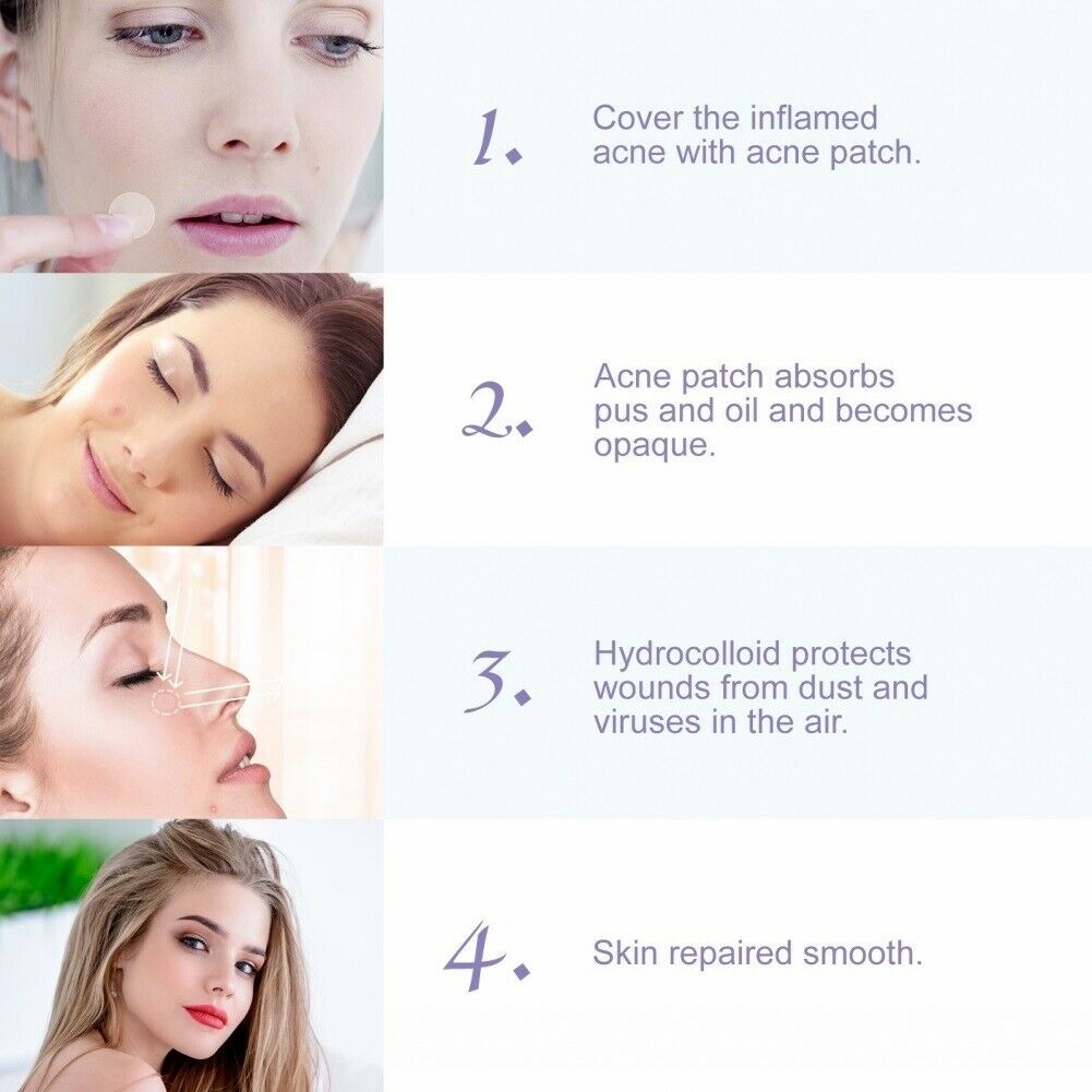 24Pcs/Sheet Invisible Acne Patches Anti-Acne Colloidal Acne-Covering Patch