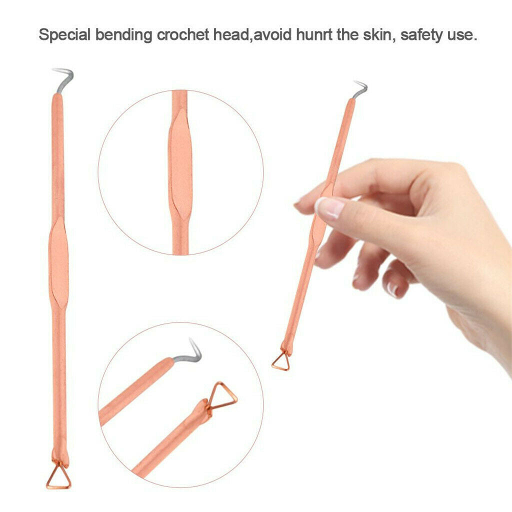 4 Piece Stainless Blackhead Acne Blemish Pimple Extractor Remover Needle Kit