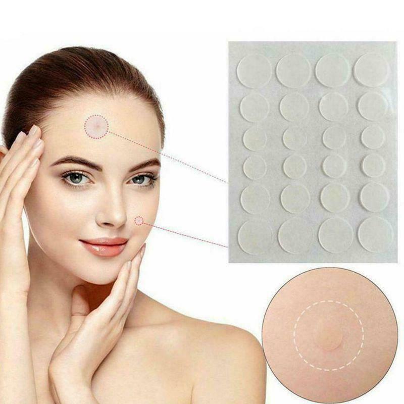 acne Pimple Patch, Hydrocolloid Acne Healing Patches, Invisible Absorbing Cover